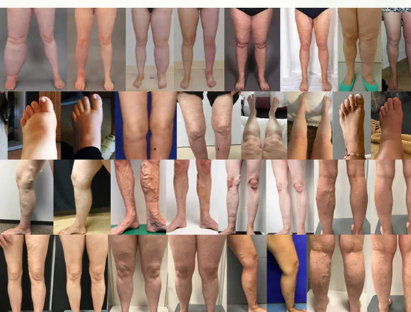 Timilk Crème Professionnelle pour la Circulation des Jambes