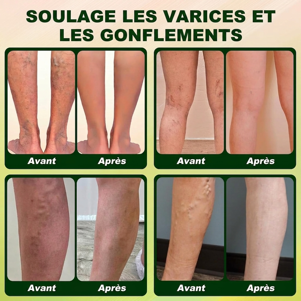 Timilk Crème Professionnelle pour la Circulation des Jambes