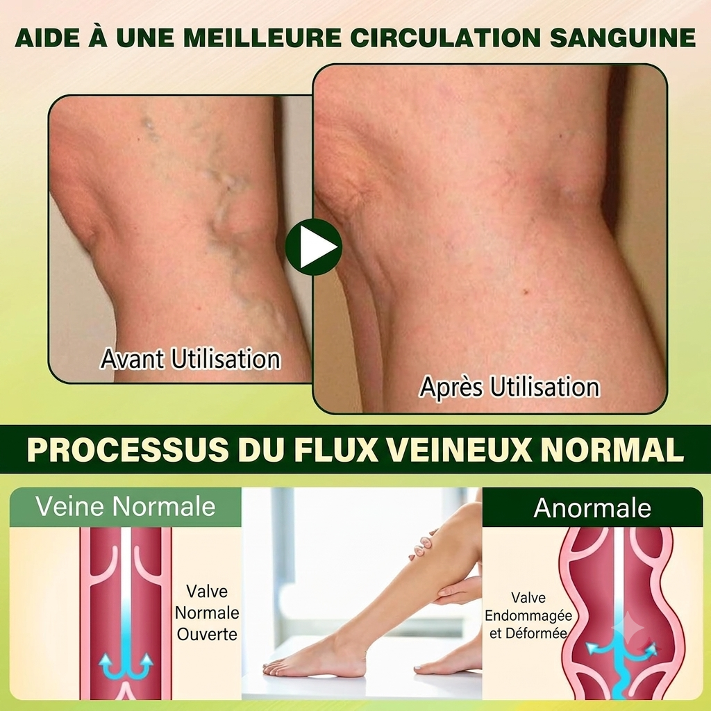 Timilk Crème Professionnelle pour la Circulation des Jambes